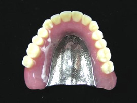 金属床義歯のイメージ