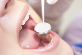 歯周病の検査のイメージ